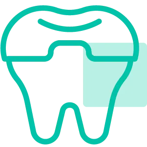 טיפול להלבנת שיניים