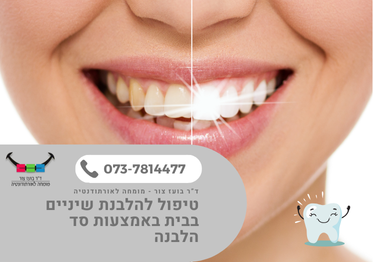טיפול להלבנת שיניים בבית באמצעות סד הלבנה